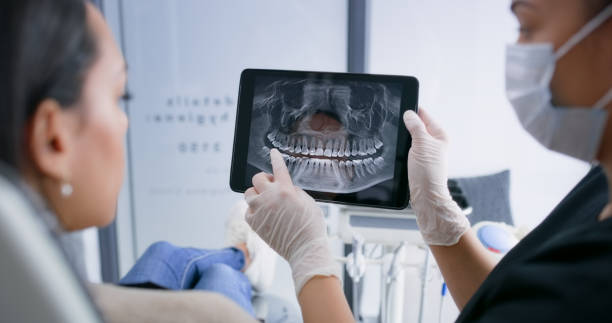 Licensed Wisdom Tooth Removal service in Orem, UT - Smile Center Dentistry